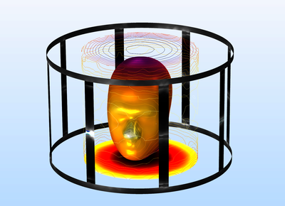 MRI Birdcage Coil