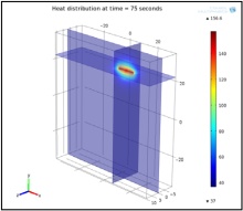 Laser Interstitial Thermo Therapy (LITT) for Prostate Cancer Animal Model: ...