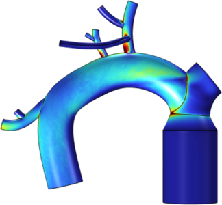 Evaluating Changes in Pulmonary Blood Vessel Shear Stress and Pressure Post ...