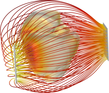 Electric Field Computation in Defibrillation Studies on Realistic Cardiac ...