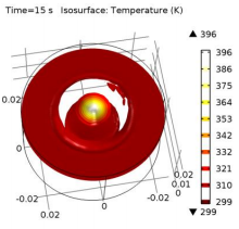 3D Simulation of Laser Interstitial Thermal Therapy in the Treatment of ...