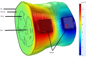 Simulating Current Distribution in Tissue During Electrical Stimulation ...
