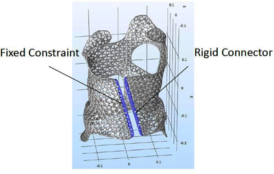 Simulation of Lattice Structures in Orthopedic Corsets