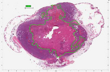 Explicit Dosimetry for Photodynamic Therapy; Singlet Oxygen Modeling based ...