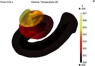 Thermal Analysis of Magnetically-Guided Cochlear Implant Surgery in a ...