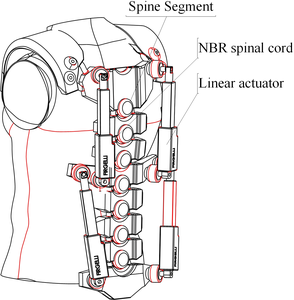 The use of 3D printed material for trunk exoskeleton system